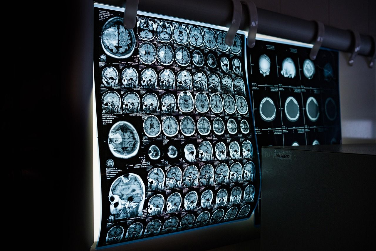 Dispositifs médicaux