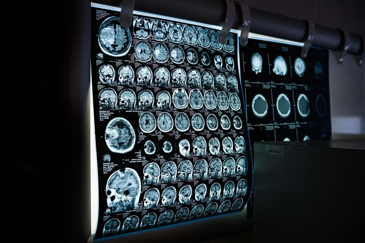 Dispositifs médicaux